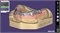 Exocad Bar Module 1139494104